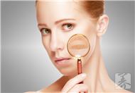 什么是过敏性皮肤病?有哪些症状？