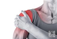 什么叫肩周炎，有哪些特征呢？