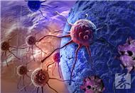 肝细胞瘤是什么以及患有肝细胞瘤的症状