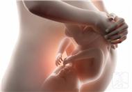 胎儿双侧脉络丛囊肿是什么？