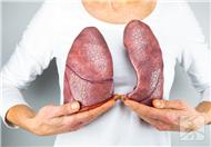肺部纤维化如何治疗？压缩雾化吸入治疗