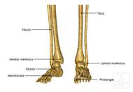 怎样判断脚踝是否骨折?临床常用这些方法