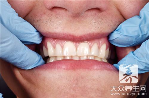 清洁牙齿的好方法有哪些？如何清洁牙WM真人入口齿？