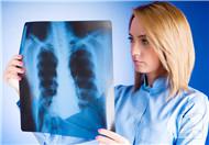 肺肿瘤放疗期间如何护理，你知道吗？