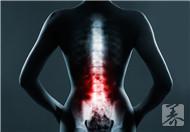 腰部以下酸痛怎么回事?六原因你须知