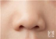 过敏性鼻炎能预防吗