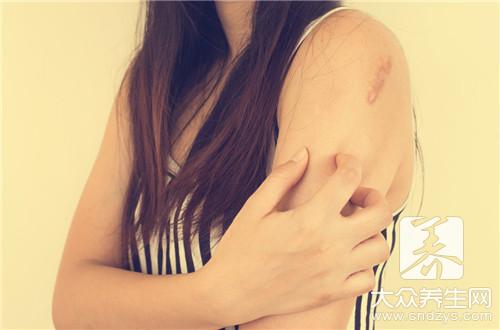 皮肤瘙痒症的症状有哪些