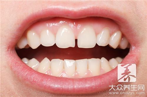 「正常健康」的牙齿颜色：「淡黄半透明」的象牙色。