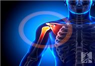 肩周炎疼痛的缓解方法有哪些?