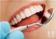 美白牙齿有副作用吗?美白牙齿能维持多久