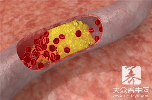 草莓型血管瘤症状以及发病原因