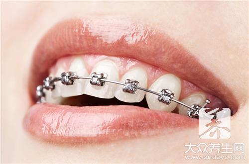 传统假牙套的危害有哪些