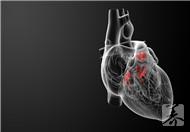 胸主動脈粥樣硬化怎麼預防