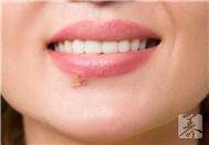 嘴唇疱疹的治疗方法是什么？