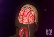 脑膜刺激征三大特征具体是什么