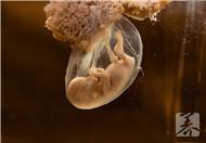 怀孕38周胎儿入盆征兆，会有什么感觉