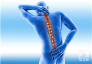 脊柱侧弯症状表现，这四点最典型