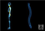 脊髓空洞症的症状表现有哪些