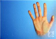 男人手指浮肿是什么原因造成的