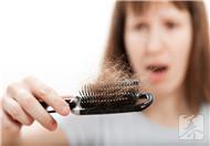 女性脱发是什么引起的？