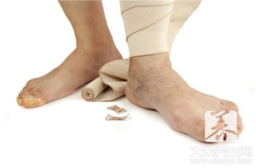 女性下肢浮肿护理方法