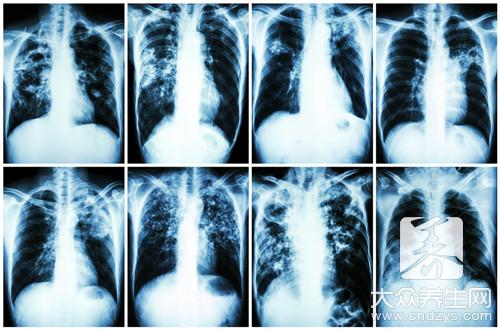 肺部肿瘤早期疾病有哪些