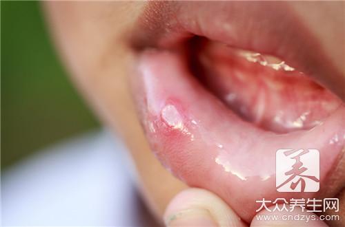 嘴上长泡预示7种致命疾病 