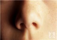 鼻炎的防治方法