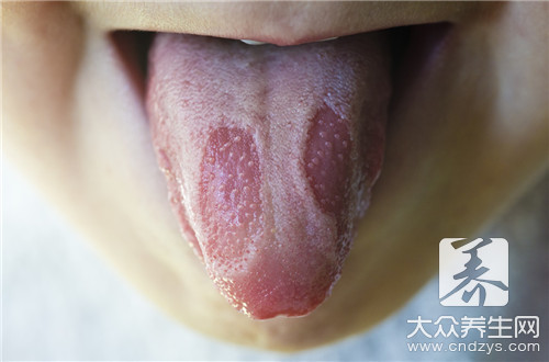 舌苔厚白怎么去除呢？有什么方法？