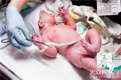  婴儿脐带流血照片