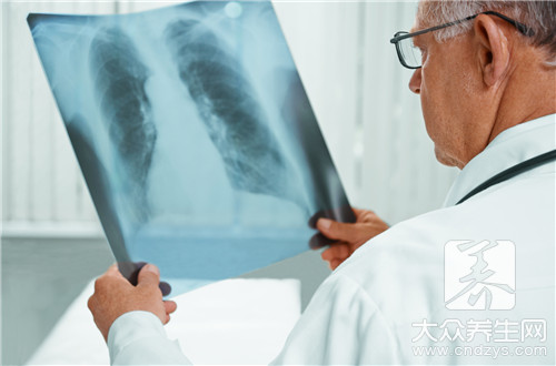 双肺间质性改变是癌症