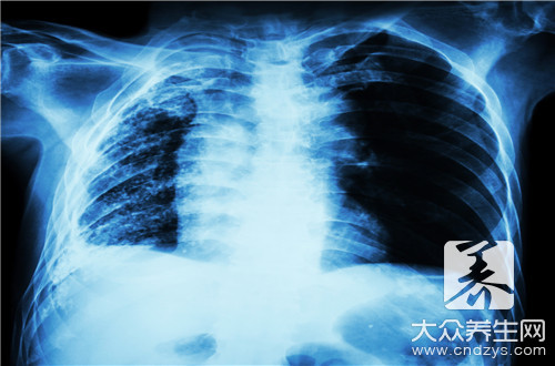 双肺间质性改变是癌症