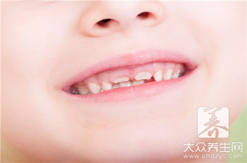 小孩换牙齿期内常见问题
