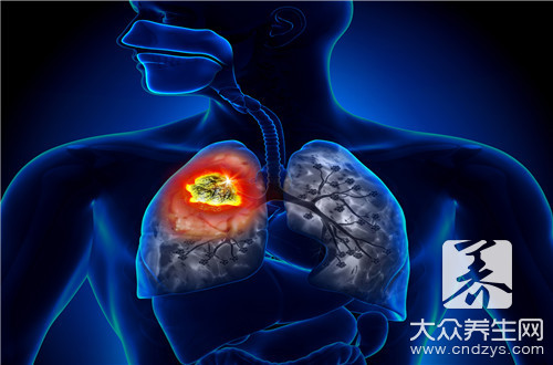 如何排除早期肺癌