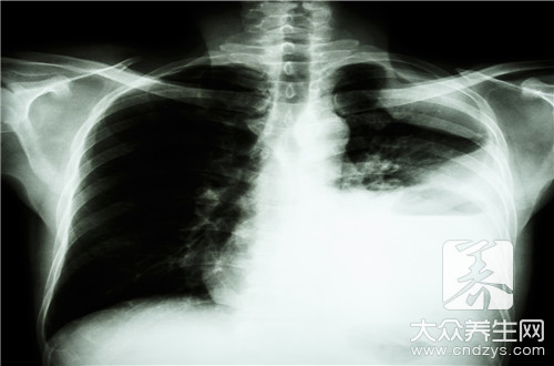 肺火旺的症状及医治 