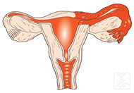 多囊卵巢综合症4个早期症状，需留意，早治疗才能好得快