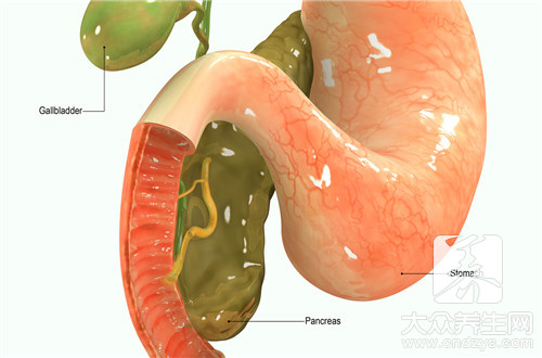 泌尿系统结石