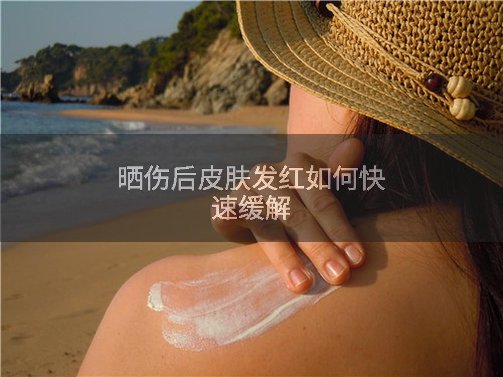 晒伤后皮肤发红如何快速缓解