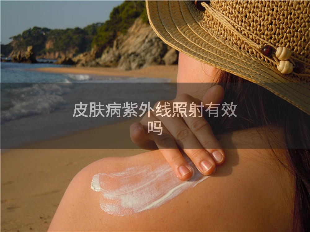 皮肤病紫外线照射有效吗