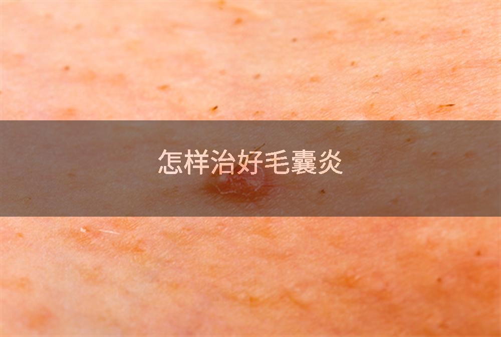 怎样治好毛囊炎