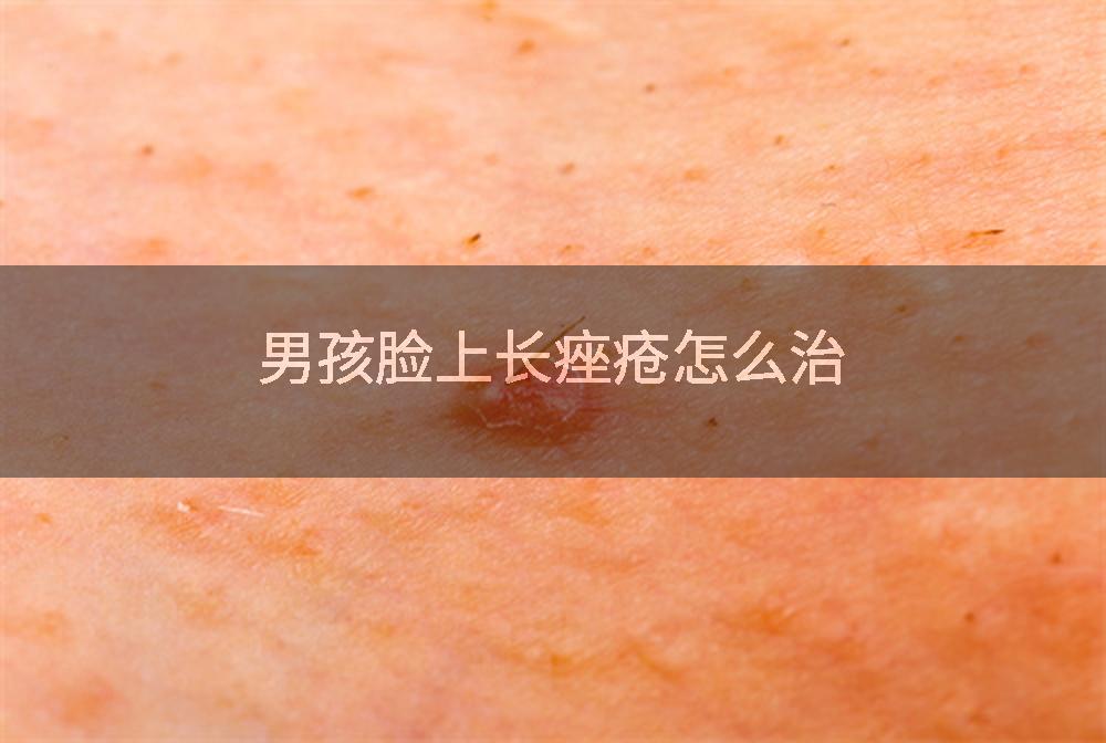 男孩脸上长痤疮怎么治