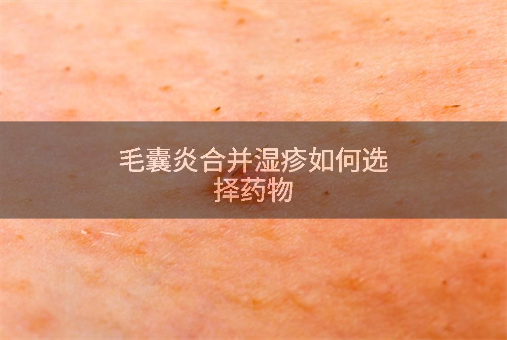 毛囊炎合并湿疹如何选择药物