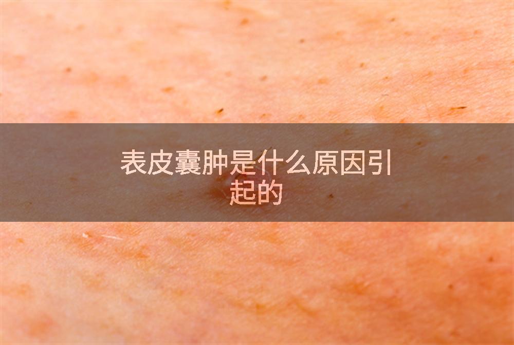 表皮囊肿是什么原因引起的