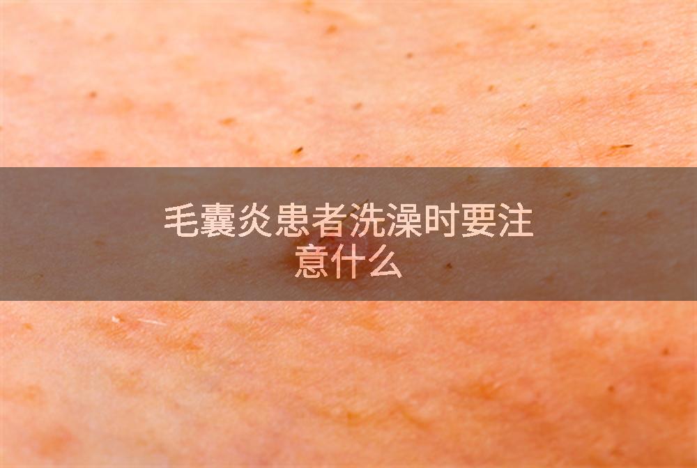 毛囊炎患者洗澡时要注意什么
