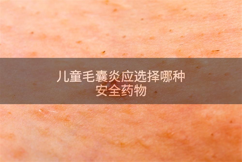儿童毛囊炎应选择哪种安全药物