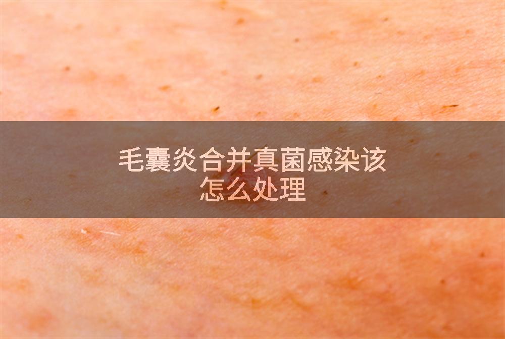 毛囊炎合并真菌感染该怎么处理
