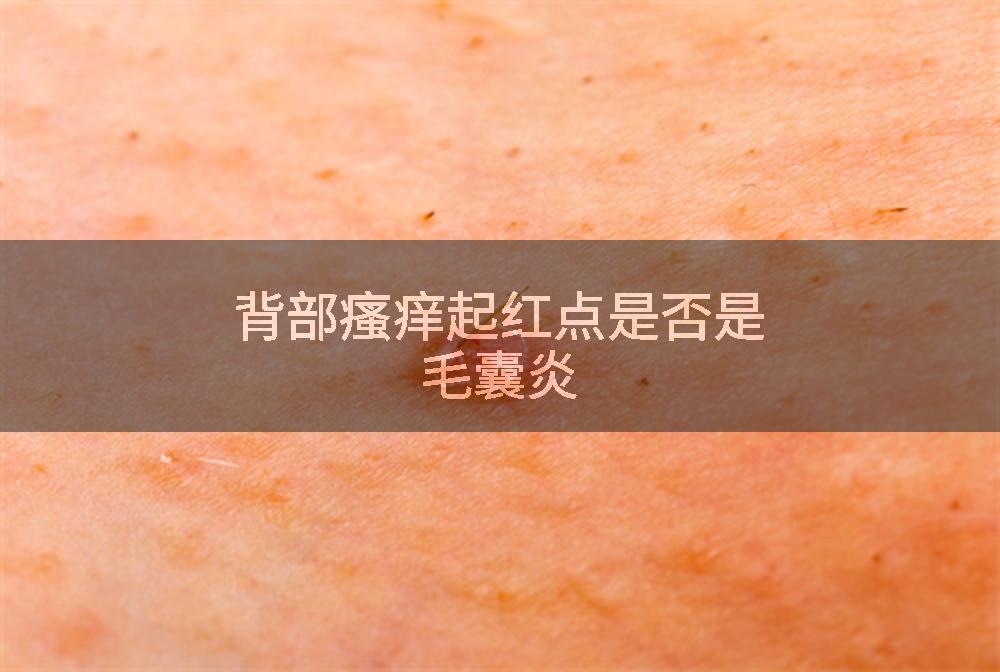 背部瘙痒起红点是否是毛囊炎