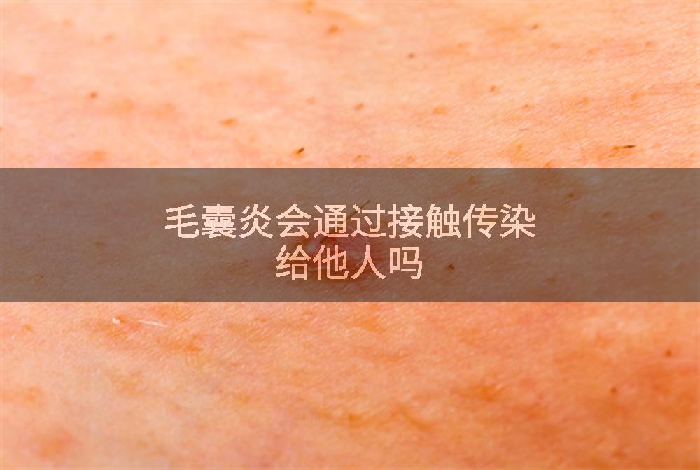 毛囊炎会通过接触传染给他人吗