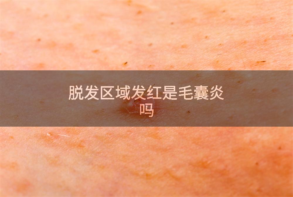 脱发区域发红是毛囊炎吗