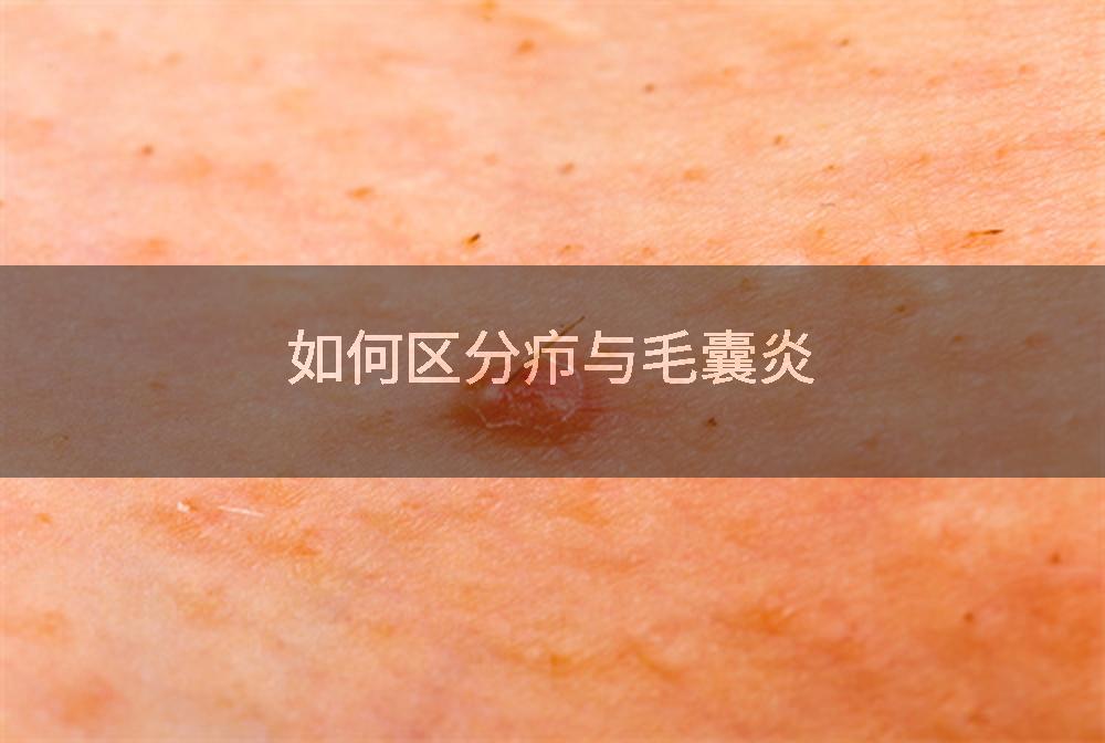 如何区分疖与毛囊炎
